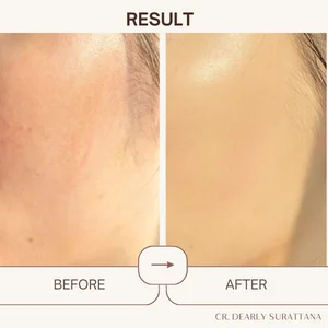 คุชชั่นเจ้านาง คุชชั่นงานผิว ปกปิด บางเบา คุชชั่น ใช้ ยัง ไง คุชชั่น ใช้ ตอน ไหน