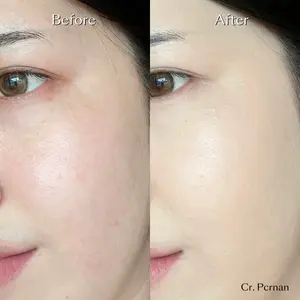 คุชชั่นปกปิดดี เปลี่ยนรอยสิว ให้เป็นผิวสวย!! ตอบโจทย์ทุกวัย คุชชั่นเจ้านาง คุชชั่นผิวสวย ให้การปกปิดได้ดีอย่างเดียวไม่พอ ต้องให้ความรู้สึกเบาสบายและดูเป็นธรรมชาติอีกด้วย!