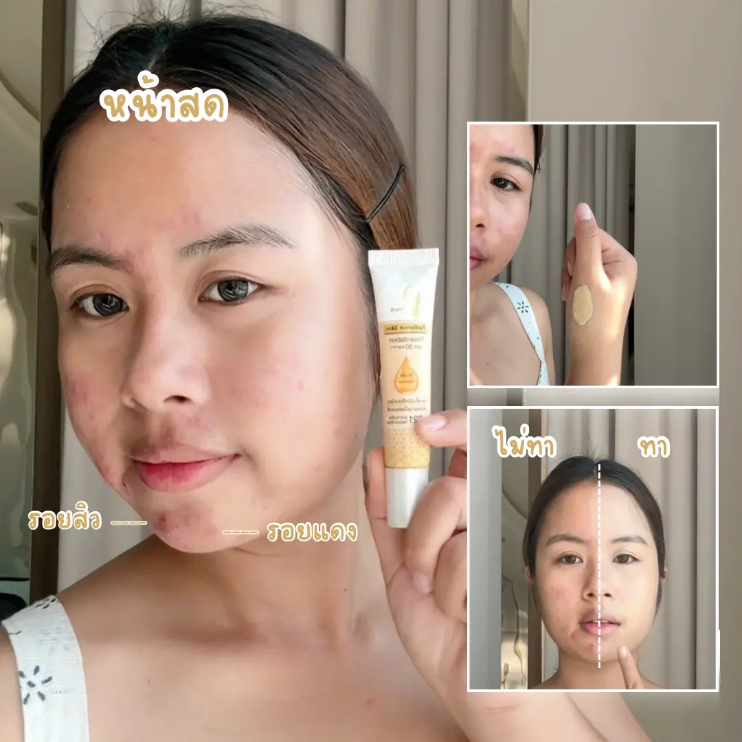 ป้ายยา รองพื้นปกปิดดี แบรนด์คนไทยที่ต้องบอกต่อ ช่วงนี้ใครกำลังมองหารองพื้นที่ให้งานผิวสวยเนียนแต่ยังดูเป็นธรรมชาติ วันนี้ขอป้ายยาตัวนี้ รองพื้นเรเดียนซ์เจ้านางแบรนด์คนไทย ติดใจจนต้องบอกต่อ